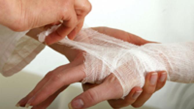 Если вы заметили порезы на руках подростка: инструкция для родителей Лечение и остановка крови